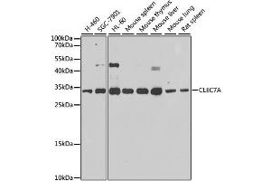 Western blot analysis of extracts of various cell lines, using CLEC7A antibody. (CLEC7A Antikörper)