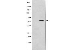 Western blot analysis of CaMK4 phosphorylation expression in H2O2 treated K562 whole cell lysates,The lane on the left is treated with the antigen-specific peptide. (CAMK4 Antikörper  (pThr200))