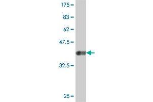 Western Blotting (WB) image for anti-Protein Kinase, Interferon-Inducible Double Stranded RNA Dependent Activator (PRKRA) (AA 101-200) antibody (ABIN563705)