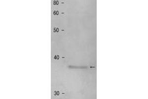 Western Blotting (WB) image for anti-Shugoshin 1 (SGOL1) antibody (ABIN2452123) (Shugoshin Antikörper)