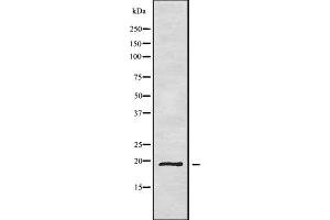 Western blot analysis of CD164L2 using HepG2 whole cell lysates (CD164L2 Antikörper)