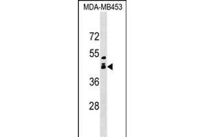 ALX1 Antibody (Center) (ABIN1538707 and ABIN2849356) western blot analysis in MDA-M cell line lysates (35 μg/lane). (ALX1 Antikörper  (AA 97-122))