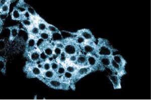 Immunofluorescent staining on HepG2 cells with anti-ALDH. (Aldehyde Dehydrogenase Antikörper  (AA 7-128))