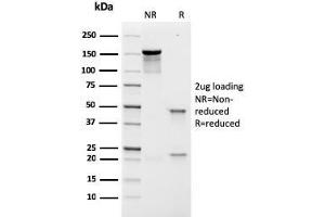 SDS-PAGE Analysis Purified Prolactin Receptor Recombinant Mouse Monoclonal (rPRLR742).