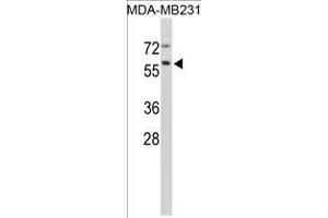 Image no. 1 for anti-Cathepsin F (CTSF) (Middle Region) antibody (ABIN452888) (Cathepsin F Antikörper  (Middle Region))