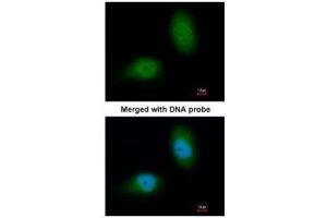 ICC/IF Image Immunofluorescence analysis of paraformaldehyde-fixed HeLa, using HSPB8, antibody at 1:200 dilution. (HSPB8 Antikörper  (C-Term))