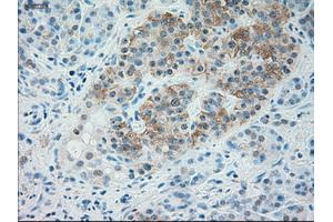 Immunohistochemical staining of paraffin-embedded liver tissue using anti-TRPM4mouse monoclonal antibody. (TRPM4 Antikörper)