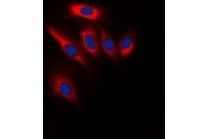 Immunofluorescent analysis of PTEN staining in Hela cells. (PTEN Antikörper  (C-Term))