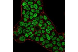 Flow Cytometric Analysis of PFA-fixed MCF-7 cells using MSH6 Mouse Monoclonal Antibody (MSH6/3086) followed by goat anti-Mouse IgG-CF488 (Blue); Isotype Control (Red). (MSH6 Antikörper  (AA 374-540))