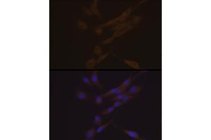 Immunofluorescence analysis of THP-1 and K562 cells using YKL-40/CHI3L1 Rabbit mAb (ABIN7266328) at dilution of 1:100 (40x lens). (CHI3L1 Antikörper)