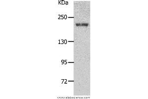 Western blot analysis of Mouse kidney tissue, using NPHS1 Polyclonal Antibody at dilution of 1:700 (Nephrin Antikörper)