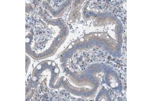 Immunohistochemical staining of human stomach with KIAA1024 polyclonal antibody  shows moderate cytoplasmic positivity in glandular cells at 1:50-1:200 dilution. (KIAA1024 Antikörper)