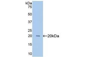 Detection of Recombinant GPC1, Human using Polyclonal Antibody to Glypican 1 (GPC1) (GPC1 Antikörper  (AA 114-277))