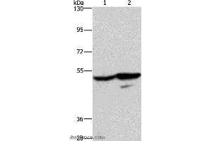 Western blot analysis of A431 and K562 cell, using GPR39 Polyclonal Antibody at dilution of 1:200