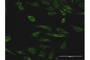 Immunofluorescence of purified MaxPab antibody to PRDX3 on HeLa cell. (Peroxiredoxin 3 Antikörper  (AA 1-256))