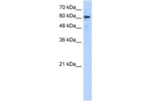 Western Blotting (WB) image for anti-ADAM Metallopeptidase Domain 30 (ADAM30) antibody (ABIN2463285) (ADAM30 Antikörper)