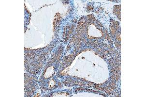 IHC analysis of SEC23IP using anti-SEC23IP antibody (ABIN7601222). (SEC23IP Antikörper  (AA 30-426))