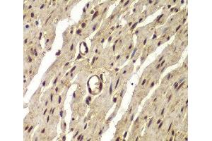 Immunohistochemistry of paraffin-embedded Human colon using PSMB8 Polyclonal Antibody at dilution of 1:100 (40x lens).