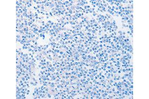 Immunohistochemistry (IHC) image for anti-Nucleosome Assembly Protein 1-Like 1 (NAP1L1) antibody (ABIN1873819)