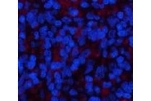 Immunofluorescence analysis of Rat spleen tissue using YAP1 Polyclonal Antibody at dilution of 1:200. (YAP1 Antikörper)