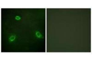Immunofluorescence analysis of HepG2 cells, using TM16G antibody. (Anoctamin 7 Antikörper  (C-Term))