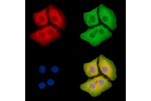 ABIN6265341 and ABIN6279794 staining Hela cells by IF/ICC. (STK25 Antikörper  (Internal Region))