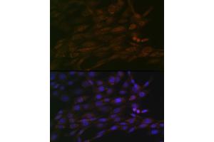 Immunofluorescence (IF) image for anti-Chromodomain Helicase DNA Binding Protein 3 (CHD3) antibody (ABIN7266363)