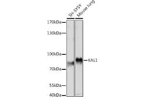 Western blot analysis of extracts of various cell lines, using K Rabbit pAb (ABIN7268068) at 1:1000 dilution. (KAL1 Antikörper  (AA 200-300))