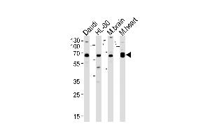 CSIN2 Antibody  (ABIN392666 and ABIN2842164) western blot analysis in Daudi,HL-60 cell line and mouse brain,rat heart lysates (35 μg/lane). (PACSIN2 Antikörper  (C-Term))