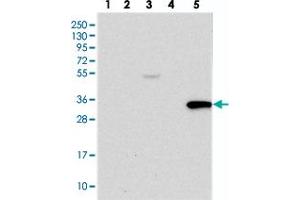 Western blot analysis of Lane 1: RT-4, Lane 2: U-251 MG, Lane 3: Human Plasma, Lane 4: Liver, Lane 5: Tonsil with TRAF3IP3 polyclonal antibody  at 1:250-1:500 dilution. (TRAF3IP3 Antikörper)