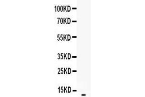 Western blot analysis of CXCL2 expression in recombinant human CXCL2 protein 0. (CXCL2 Antikörper  (AA 39-107))