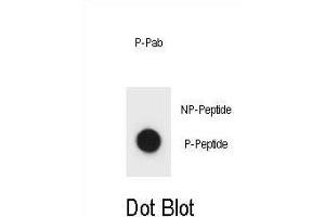Dot blot analysis of IKKB Antibody (Phospho ) Phospho-specific Pab (ABIN1881450 and ABIN2850469) on nitrocellulose membrane. (IKBKB Antikörper  (pSer177))