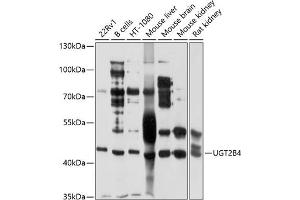 Western blot analysis of extracts of various cell lines, using UGT2B4 antibody (ABIN1683211, ABIN3018660, ABIN3018661 and ABIN6220530) at 1:1000 dilution. (UGT2B4 Antikörper  (AA 280-480))