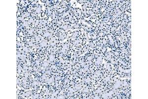 IHC analysis of splicing factor 1 using anti-splicing factor 1 antibody (ABIN7600193).