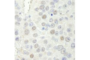 Immunohistochemistry (IHC) image for anti-RNA polymerase-associated protein RTF1 homolog (RTF1) (C-Term) antibody (ABIN7449019)