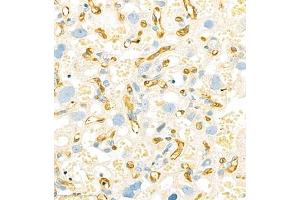 Immunohistochemistry (Paraffin-embedded Sections) (IHC (p)) image for anti-Homer Homolog 3 (Drosophila) (HOMER3) antibody (ABIN7074257)