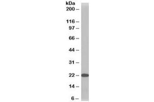 Western blot testing of HeLa lysate with TMS1 antibody at 1ug/ml.