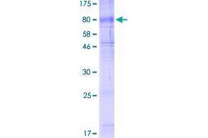 SLC40A1 Protein (AA 1-571) (GST tag)