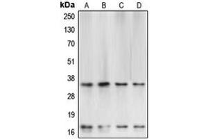Western blot analysis of Caspase 3 expression in HeLa (A), SP2/0 (B), Raw264. (Caspase 3 Antikörper  (Center))