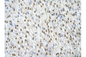Rabbit Anti-ILF3 antibody   Paraffin Embedded Tissue: Human Heart cell Cellular Data: cardiac cell of renal tubule Antibody Concentration: 4. (Interleukin enhancer-binding factor 3 (ILF3) (N-Term) Antikörper)