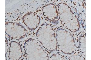 ABIN6267039 at 1/50 staining human colon tissue sections by IHC-P. (Histone 3 Antikörper)
