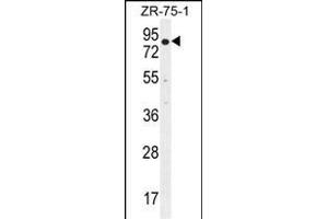 BTRC Antibody (N-term) (ABIN655814 and ABIN2845238) western blot analysis in ZR-75-1 cell line lysates (35 μg/lane). (BTRC Antikörper  (N-Term))