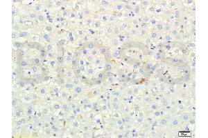 Formalin-fixed and paraffin embedded rat liver tissue labeled with Anti-SREBP-2 Polyclonal Antibody, Unconjugated (ABIN751258) at 1:200 followed by conjugation to the secondary antibody and DAB staining (SREBF2 Antikörper)