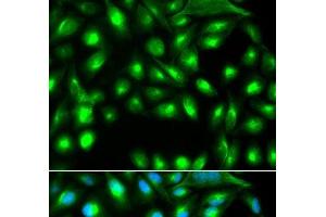 Immunofluorescence analysis of A549 cells using GEMIN2 Polyclonal Antibody (SIP1 Antikörper)