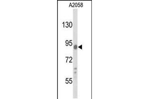 Western blot analysis of COG4 Antibody in A2058 cell line lysates (35ug/lane) (COG4 Antikörper  (C-Term))