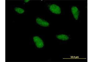 Immunofluorescence of purified MaxPab antibody to SAP18 on HeLa cell. (SAP18 Antikörper  (AA 1-153))