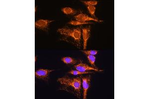 Immunofluorescence analysis of C6 cells using  Rabbit pAb (ABIN1678653, ABIN5664340, ABIN5664342 and ABIN6220284) at dilution of 1:100. (AMPD1 Antikörper  (AA 50-260))