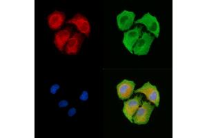 ABIN6263377 and ABIN6278723 staining  cells by IF/ICC. (MRPS11 Antikörper  (C-Term))