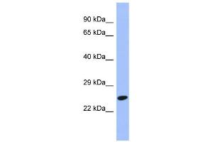 WB Suggested Anti-DRAP1 Antibody Titration: 0.