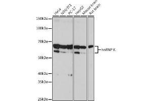 Western blot analysis of extracts of various cell lines, using hnRNP K antibody (ABIN7267634) at 1:2000 dilution. (HNRNPK Antikörper)